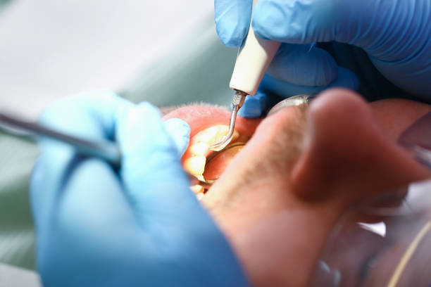 Best Dentist for Tooth Abscess  in Tampa, FL