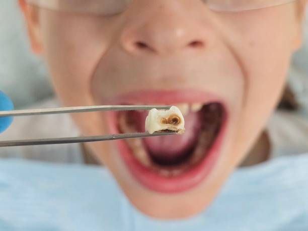 Best Cracked Tooth Emergency Dentist  in Tampa, FL